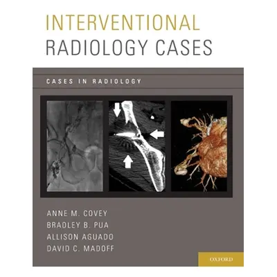 "Interventional Radiology Cases" - "" ("Covey Anne M.")