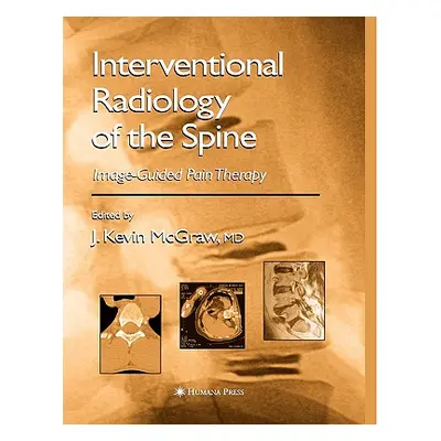 "Interventional Radiology of the Spine: Image-Guided Pain Therapy" - "" ("McGraw J. Kevin")