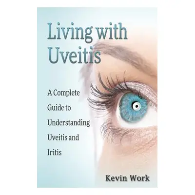 "Living with Uveitis: A Complete Guide to Uveitis and Iritis" - "" ("Work Kevin")