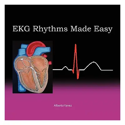 "EKG Rhythms Made Easy" - "" ("Yanez Alberto")