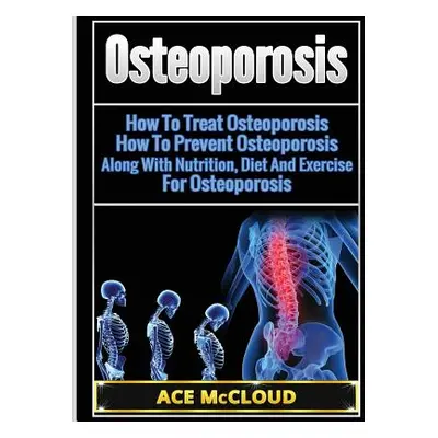 "Osteoporosis: How To Treat Osteoporosis: How To Prevent Osteoporosis: Along With Nutrition, Die