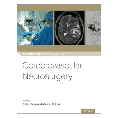 "Cerebrovascular Neurosurgery" - "" ("Nakaji Peter")