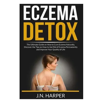 "Eczema Detox: The Ultimate Guide on How to Cure Eczema Naturally, Discover the Tips on How to G