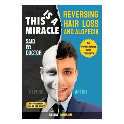 "This Is a Miracle Said My Doctor: Reversing Hair Loss and Alopecia" - "" ("Dursun Selim")