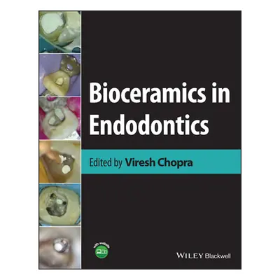 "Bioceramics in Endodontics" - "" ("Chopra Viresh")