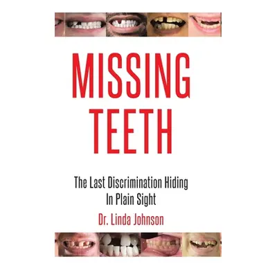 "Missing Teeth: The Last Discrimination Hiding in Plain Sight" - "" ("Johnson Linda")