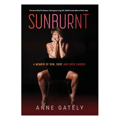 "Sunburnt: A memoir of sun, surf and skin cancer" - "" ("Gately Anne C.")