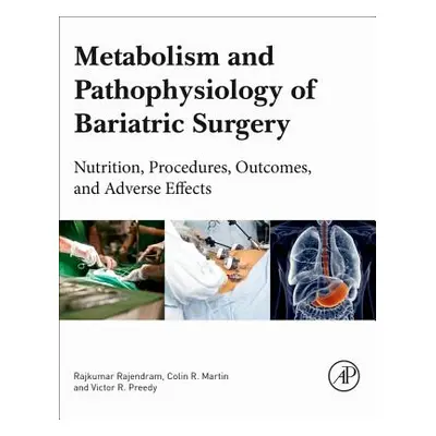 "Metabolism and Pathophysiology of Bariatric Surgery: Nutrition, Procedures, Outcomes and Advers