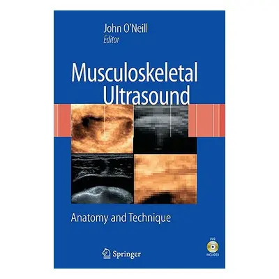 "Musculoskeletal Ultrasound: Anatomy and Technique [With DVD]" - "" ("O'Neill John M. D.")