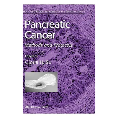 "Pancreatic Cancer: Methods and Protocols" - "" ("Su Gloria H.")