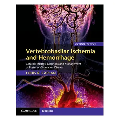 "Vertebrobasilar Ischemia and Hemorrhage: Clinical Findings, Diagnosis and Management of Posteri