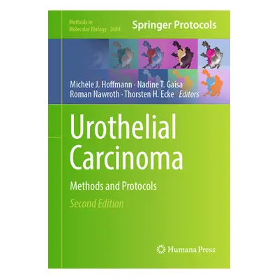 "Urothelial Carcinoma: Methods and Protocols" - "" ("Hoffmann Michle J.")