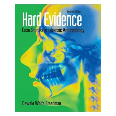 "Hard Evidence: Case Studies in Forensic Anthropology" - "" ("Steadman Dawnie Wolfe")