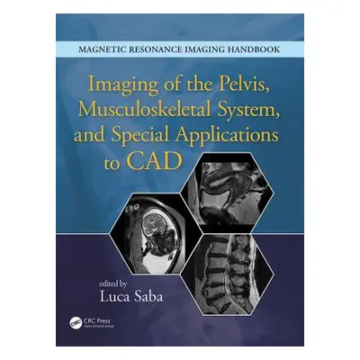 "Imaging of the Pelvis, Musculoskeletal System, and Special Applications to CAD" - "" ("Saba Luc