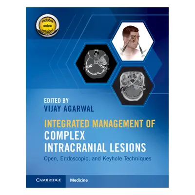 "Integrated Management of Complex Intracranial Lesions Hardback Set and Static Online Product: O