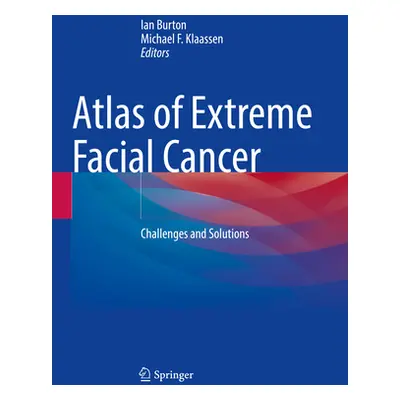 "Atlas of Extreme Facial Cancer: Challenges and Solutions" - "" ("Burton Ian")