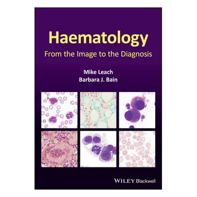 "Haematology: From the Image to the Diagnosis" - "" ("Leach Mike")